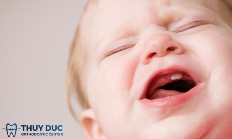 Trẻ chậm mọc răng nên bổ sung gì? Các loại thực phẩm nên bổ sung cho trẻ 1