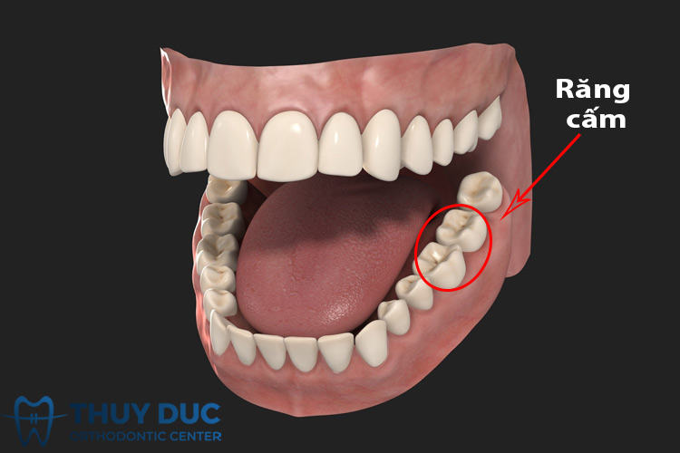 Răng cấm có thay không? Tìm hiểu sâu về chức năng và chăm sóc răng cấm