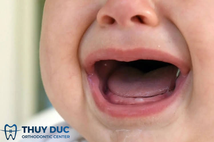 Tại sao thiếu canxi khiến trẻ mọc răng chậm? 1