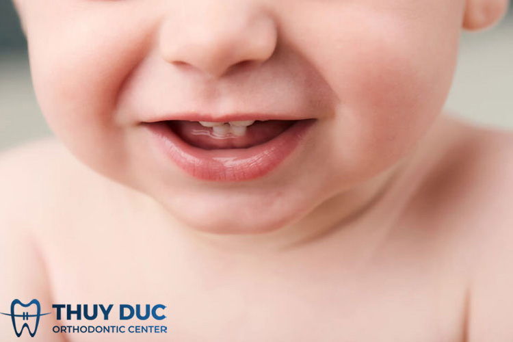 Trẻ mọc răng sớm nhất là mấy tháng? Mọc răng sớm có sao không? 1