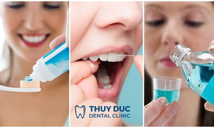 Cách chăm sóc răng miệng sau khi điều trị viêm lợi trùm có mủ 1