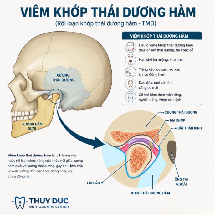 1. Nguyên nhân gây viêm khớp thái dương hàm 1 1. Nguyên nhân gây viêm khớp thái dương hàm 1