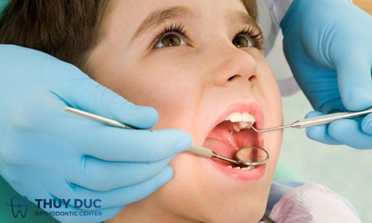 Tác hại của bệnh sâu răng ở trẻ em? 1