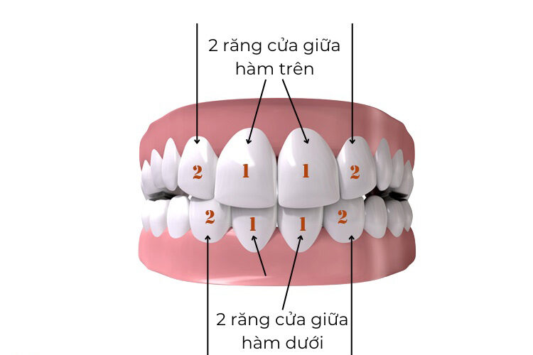 Răng cửa – cấu tạo, chức năng và các vấn đề thường gặp