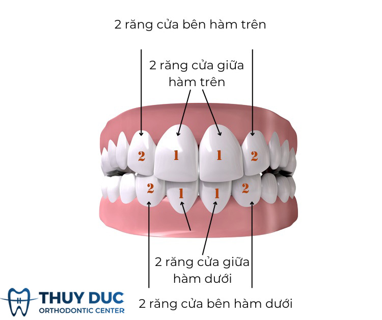 Đặc điểm của răng cửa 1