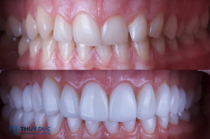 Kỹ thuật cao, đòi hỏi bác sĩ có chuyên môn tốt 1