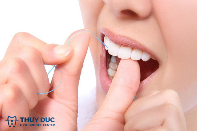 Lưu ý chăm sóc răng miệng sau khi trám răng composite 1