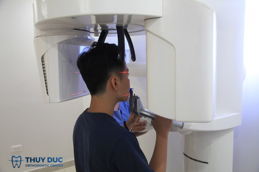 Quy trình chụp X – quang răng khôn 1