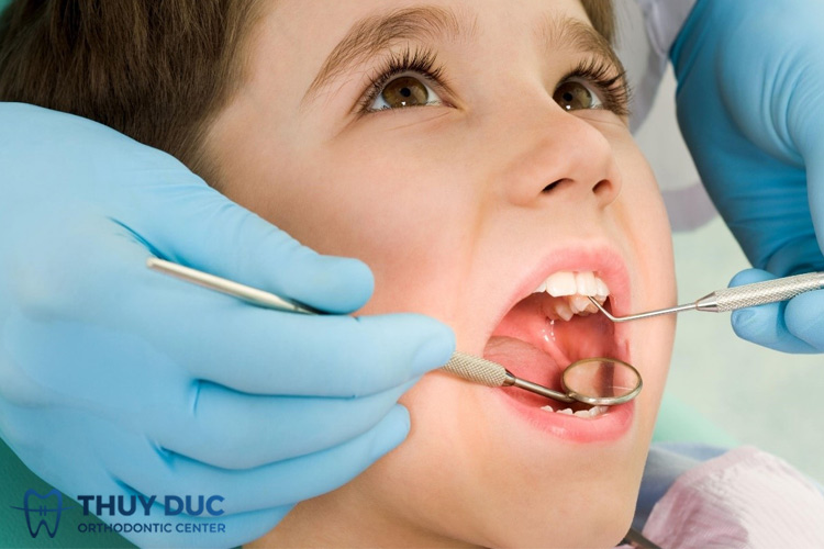 Chẩn đoán tình trạng nghiến răng khi ngủ ở trẻ em 1