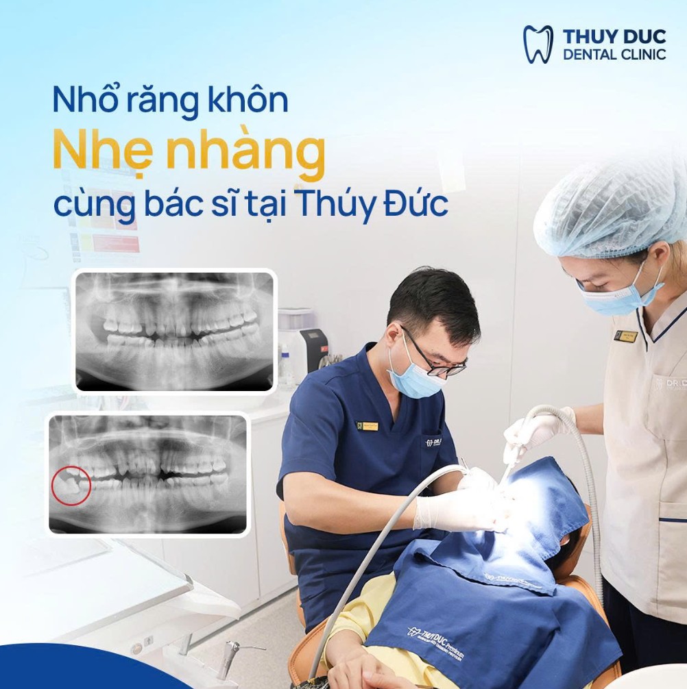 Niềng răng có thể nhổ nhiều nhất bao nhiêu cái răng? 2 Niềng răng có thể nhổ nhiều nhất bao nhiêu cái răng? 2
