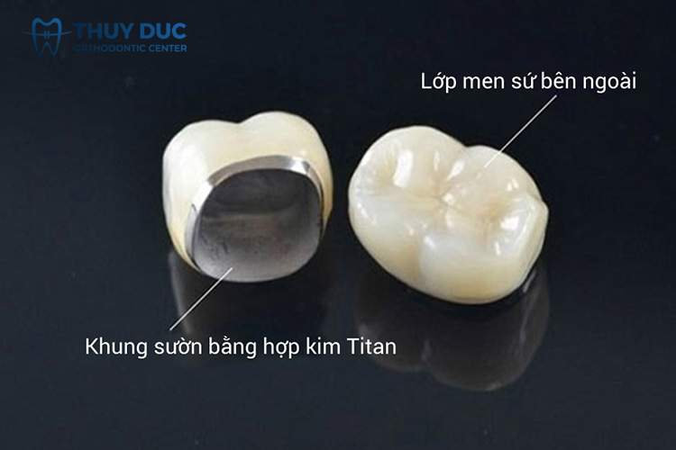 Cấu tạo của mão sứ? 1