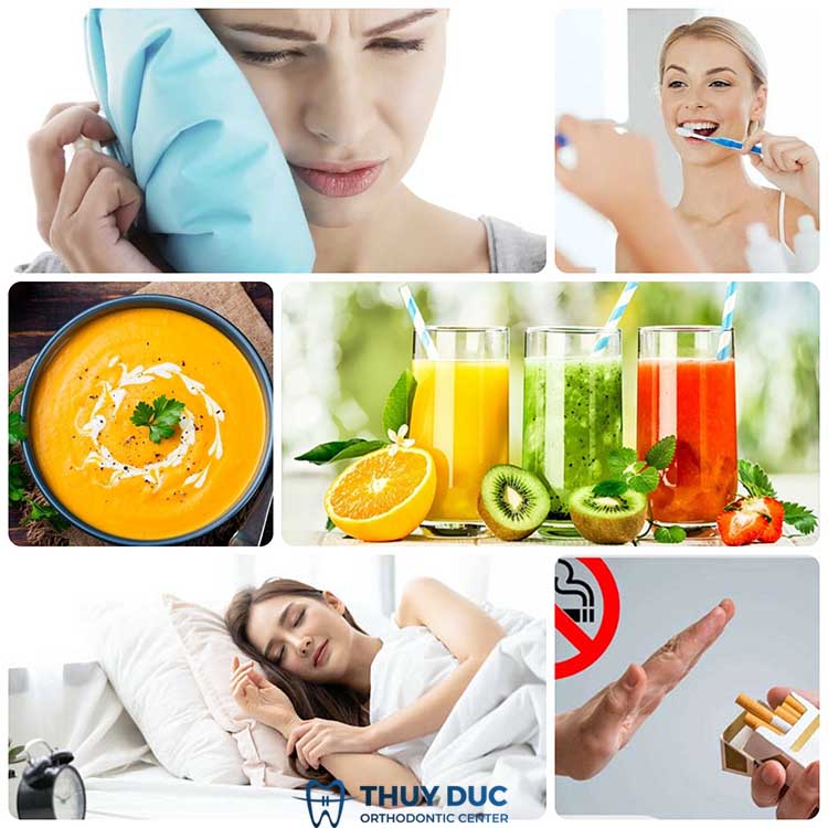 Những lưu ý sau khi nhổ răng 1