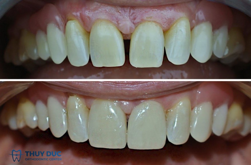Đánh giá ưu - nhược điểm 1