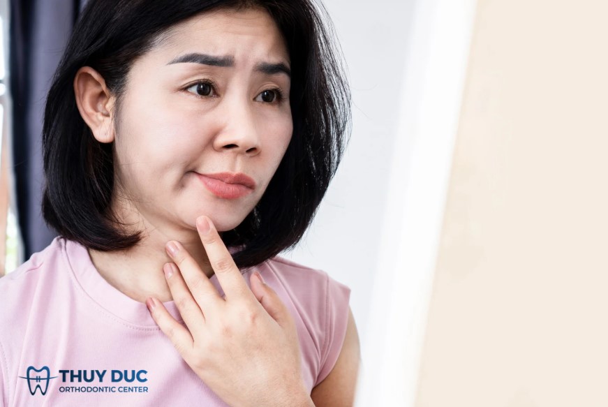 Do mặt lệch 1