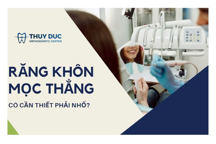 Răng khôn mọc thẳng có nên nhổ không? 1