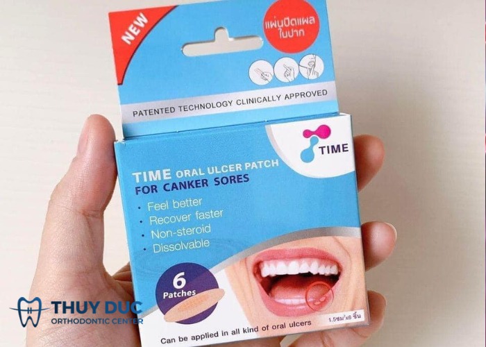 Miếng dán nhiệt miệng Time Oral Ulcer Patch 1