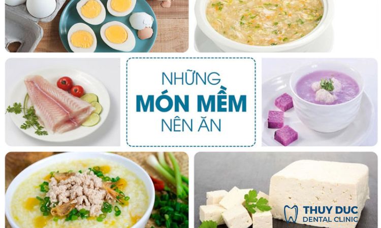 Những lưu ý cần thiết sau khi cắt chỉ răng khôn? 1