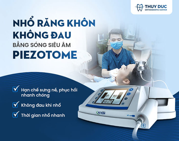 Nhổ răng khôn ở đâu uy tín? 1