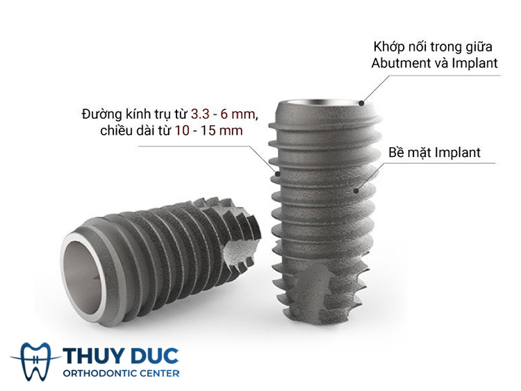 Cấu tạo của trụ Implant DIO 1