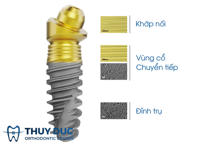 Chi tiết cấu của trụ Implant ETK Pháp 1