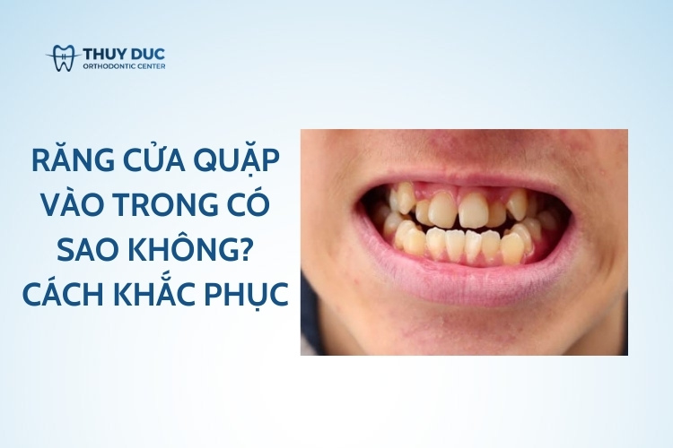 Răng cửa quặp vào trong có sao không? Cách khắc phục 1