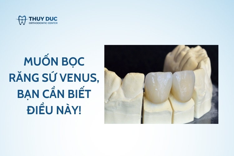 Muốn bọc răng sứ venus, bạn cần biết điều này! 1