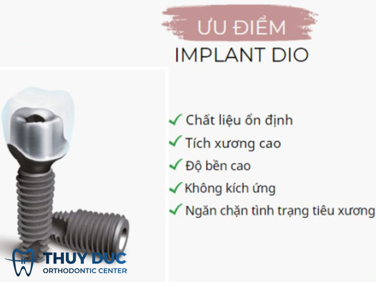 Ưu điểm của trụ Implant DIO 1