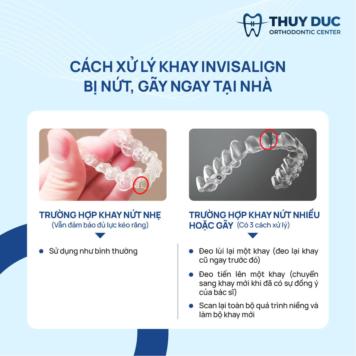 4. Khay niềng Invisalign làm từ Smarttrack có thể bị vỡ không? 1