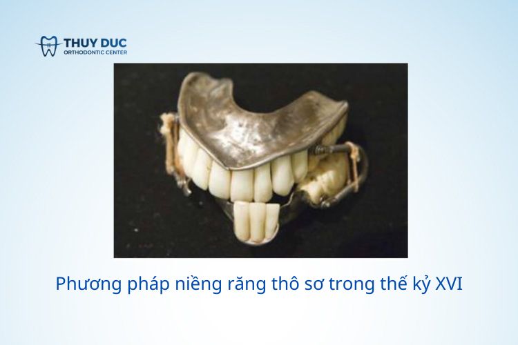 Lịch sử phát triển của chỉnh nha 2