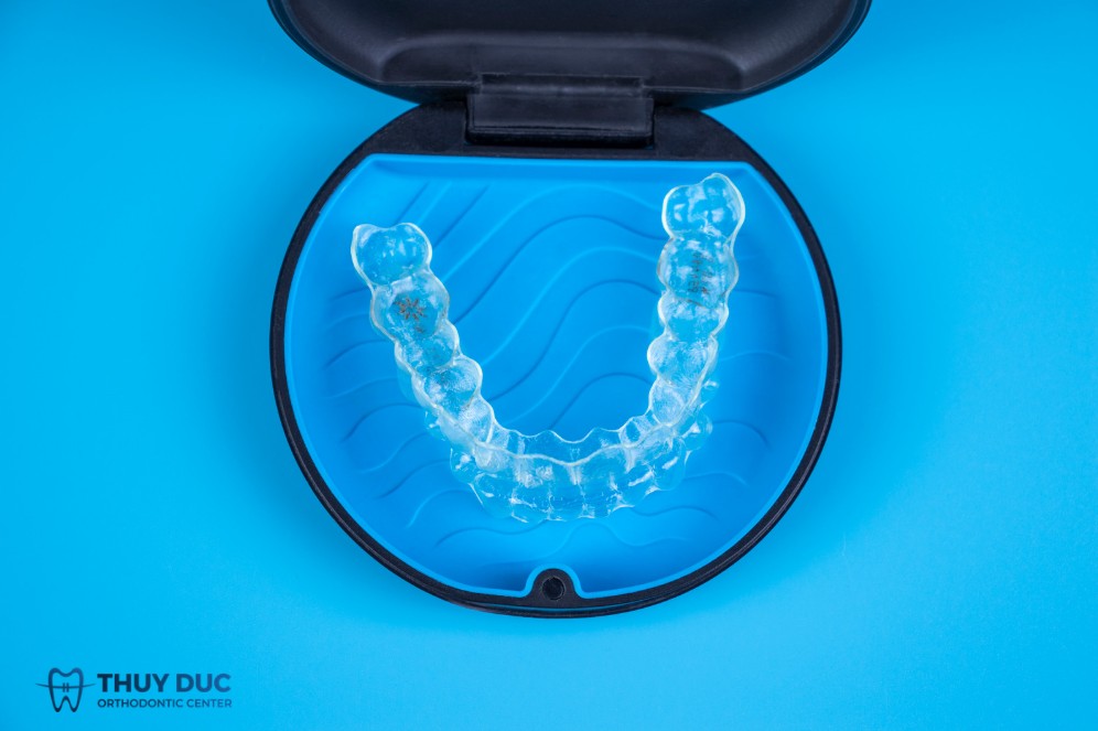 Quy trình chế tạo khay niềng trong suốt Invisalign chi tiết nhất 1 Quy trình chế tạo khay niềng trong suốt Invisalign chi tiết nhất 1