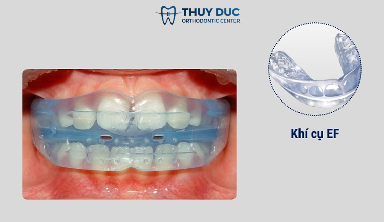 EF – Khí cụ chỉnh hình chức năng 1