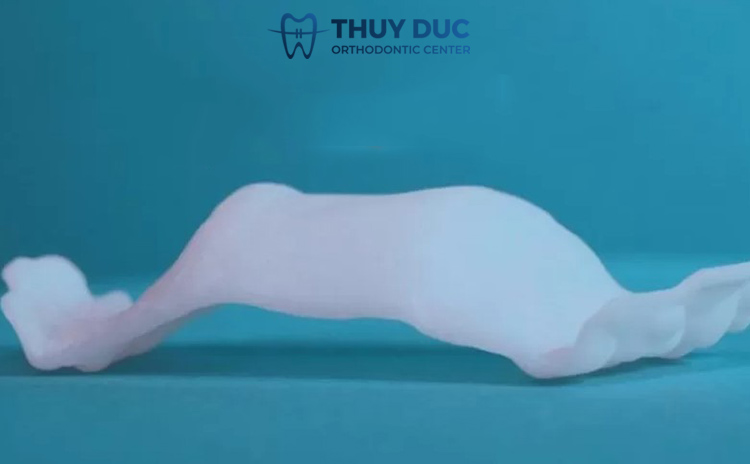 Khí cụ nong hàm - Invisalign IPE 1