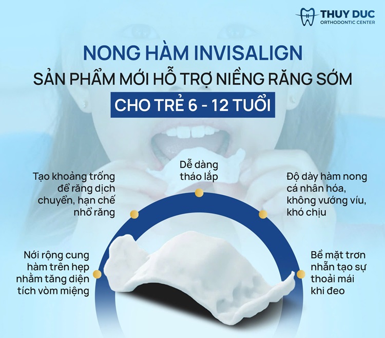 Nong hàm Invisalign IPE- công nghệ mới nhất hiện nay 1