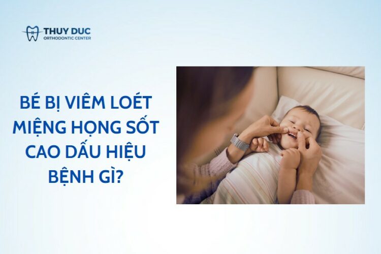 Bé bị viêm loét miệng họng sốt cao dấu hiệu bệnh gì?