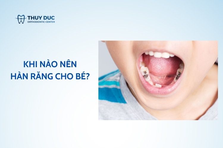Khi nào nên hàn răng cho bé? Chi phí hàn răng bao nhiêu?