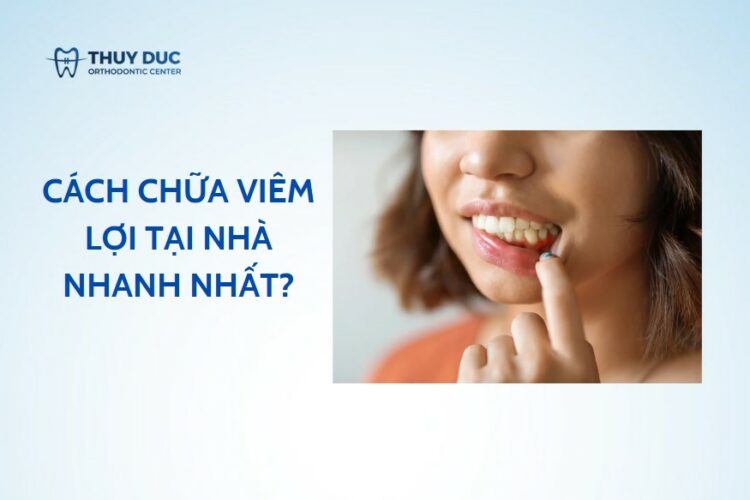 Cách chữa viêm lợi tại nhà nhanh nhất – là các nào?