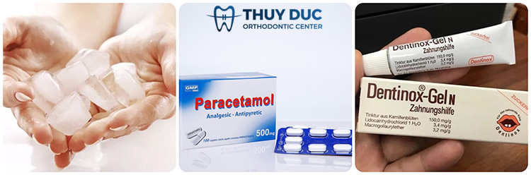 Điều trị viêm lợi cho trẻ tại nhà ở mức độ nhẹ 2
