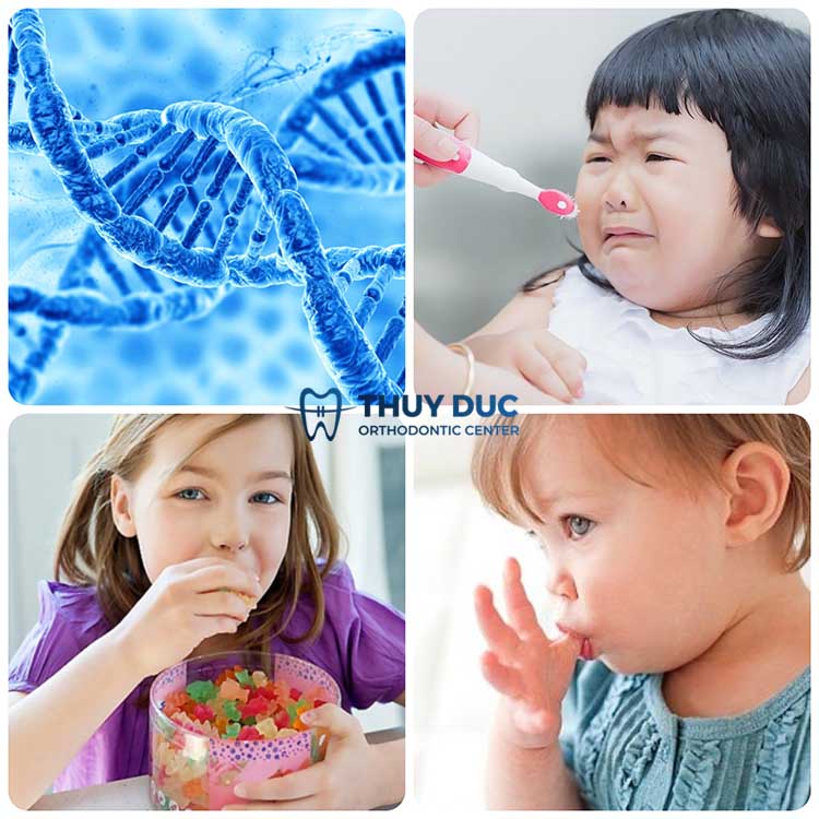 Các nguyên nhân chính gây bệnh răng miệng thường gặp ở trẻ 1