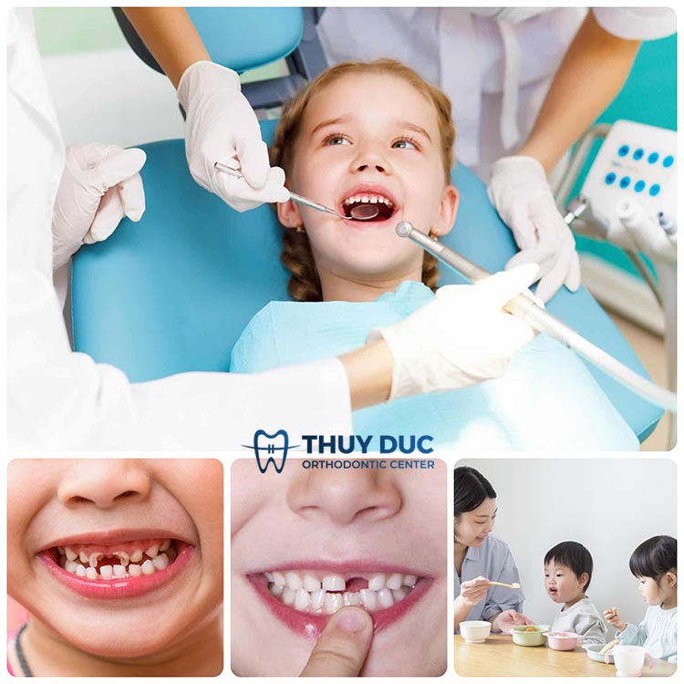Vì sao cần thăm khám răng định kỳ cho trẻ? 1