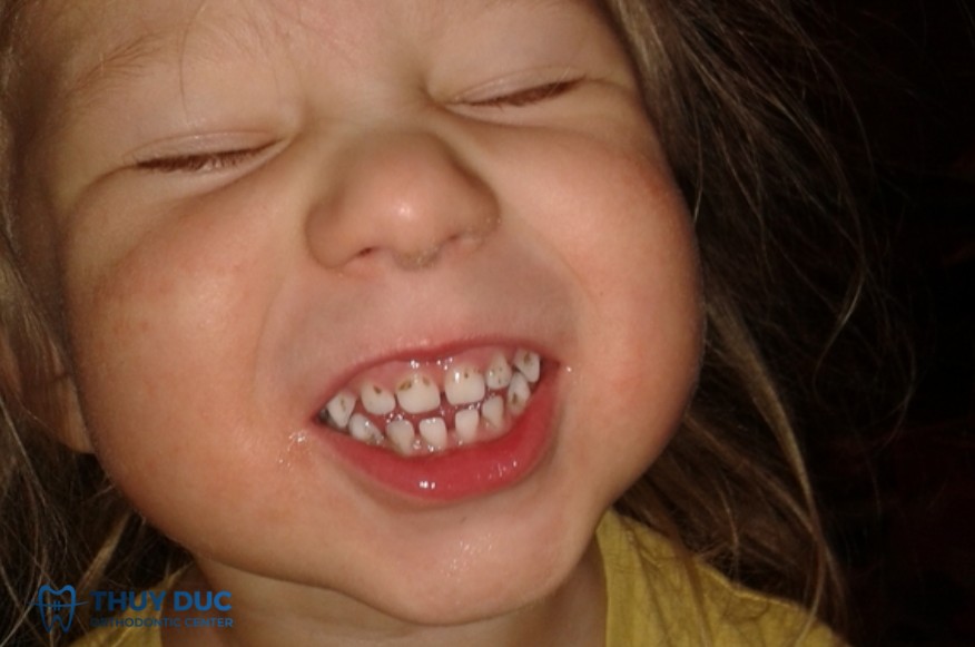 3. Ảnh hưởng của thuốc chứa sắt 1