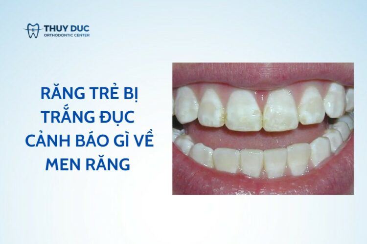 Răng trẻ bị trắng đục – cảnh báo gì về men răng của trẻ