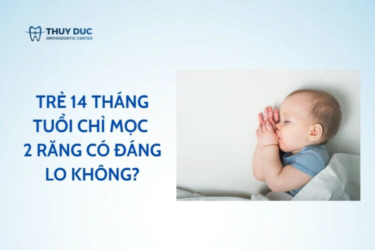 Trẻ 14 tháng tuổi mọc 2 răng – có đáng lo không?