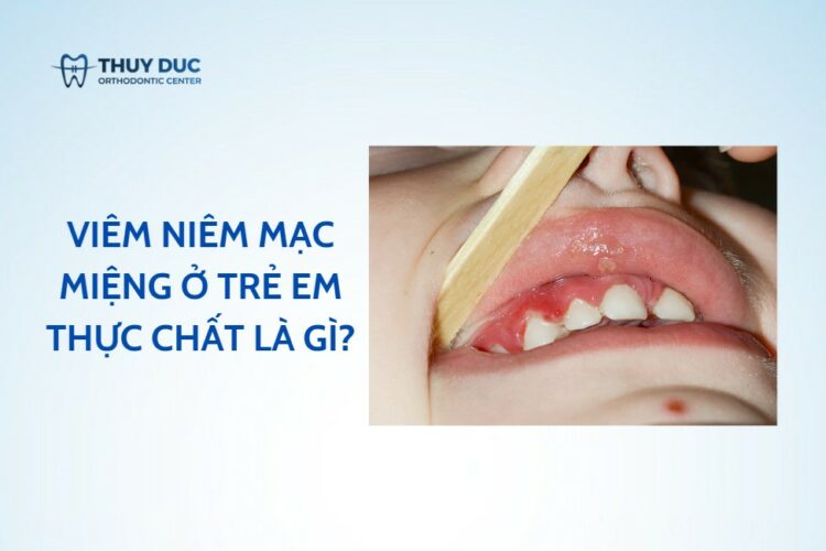 Viêm niêm mạc miệng ở trẻ em thực chất là gì?