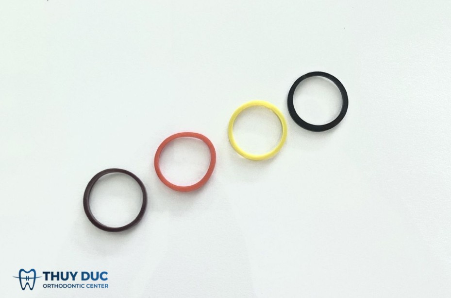2. Thực trạng “tự chế niềng răng” tại nhà 1 2. Thực trạng “tự chế niềng răng” tại nhà 1