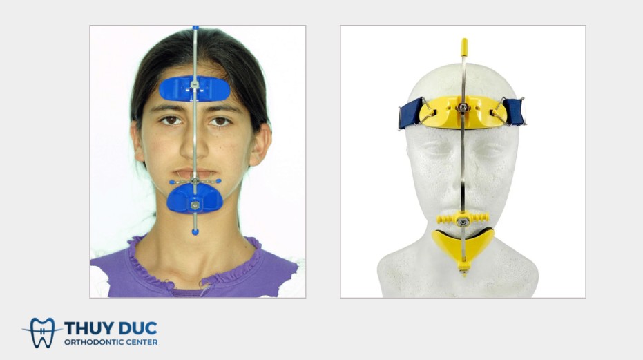 2.2 Facemask kiểu Petit 1