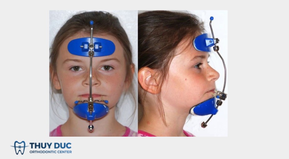 4. Nguyên lý hoạt động của Facemask 1