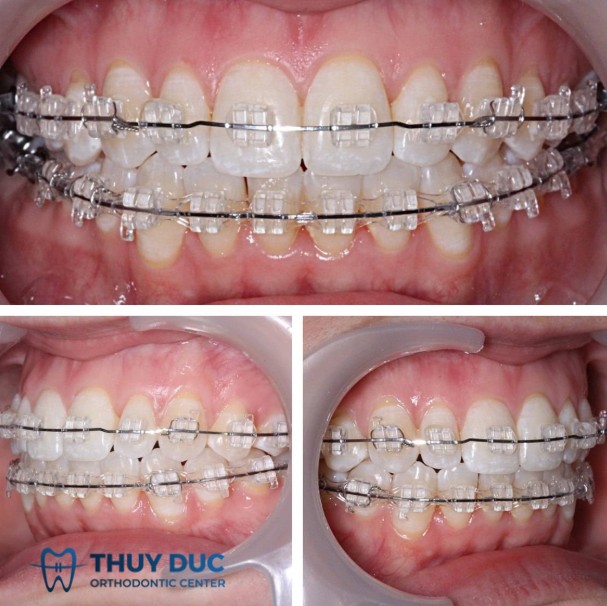 Nhận định từ nha khoa hiện đại 1