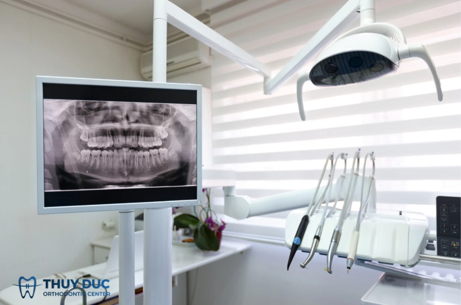 X-quang răng là gì? Hiểu cơ bản về X-quang nha khoa 1 X-quang răng là gì? Hiểu cơ bản về X-quang nha khoa 1