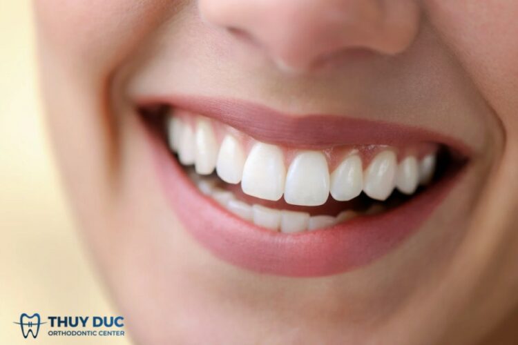 3. Các yếu tố quyết định một nụ cười tự tin 1