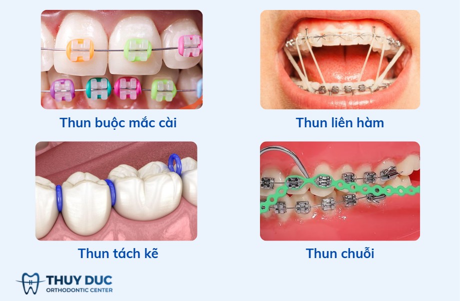 2. Phân loại theo chức năng 1 2. Phân loại theo chức năng 1
